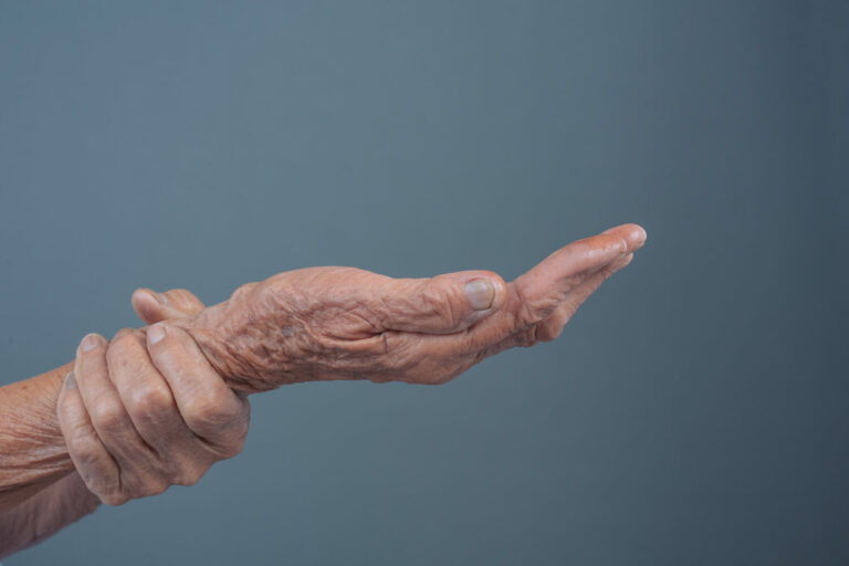 Read more about the article Κάνναβη και αρθρίτιδα